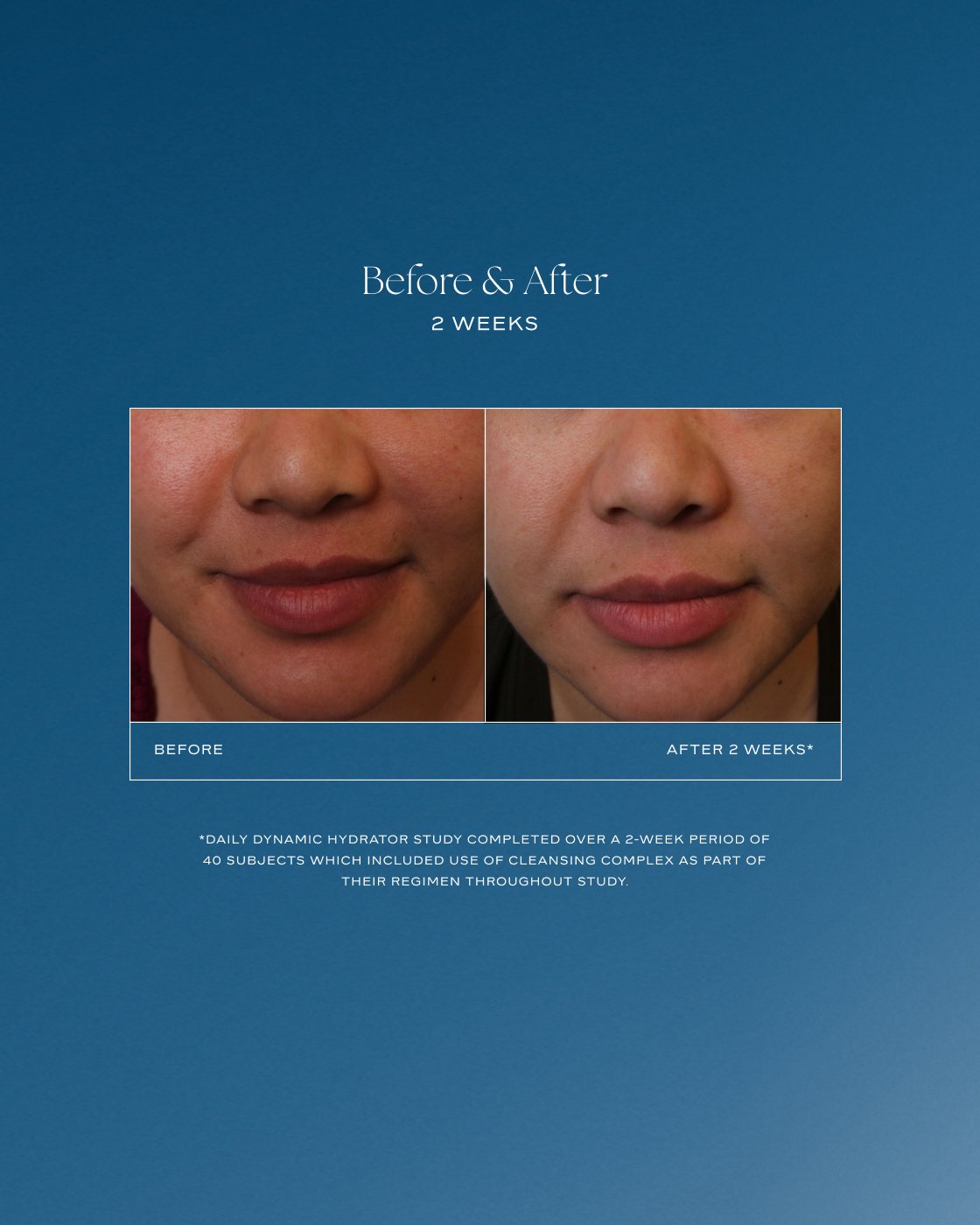 Daily Dynamic Hydrator
